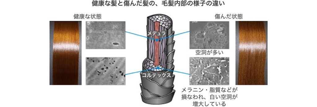 髪の内部の痛みについて