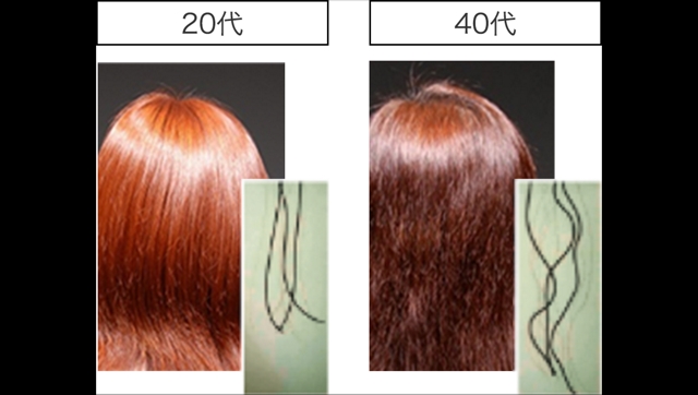 加齢による「うねり」の増加とツヤの低下