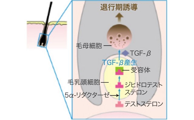 男性の薄毛について