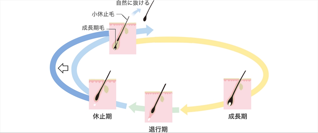 女性の薄毛について